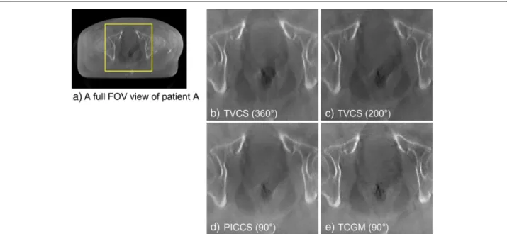 Fig. 9 Comparison of motion artifact from rectum of patient A. The yellow box on image a shows the enlarged area of the axial images of patient A, the fourth phase