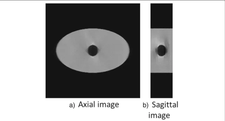 Fig. 5 Reconstructed images of a digital phantom of the fifth phase out of nine phases in the case of the sphere speed of 3 cm/60 s, using the TCGM method