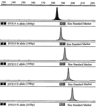 Table 2. Frequency distribution of the alleles of the Y-linked microsatellite polymorphic marker DYS19 among Japanese males with prostate cancer and their matched controls