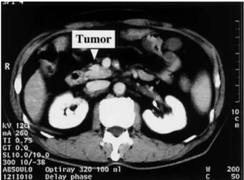 Fig. 4a. CE-CT revealed decrease of liver metastases in number and size after 14 days administration.