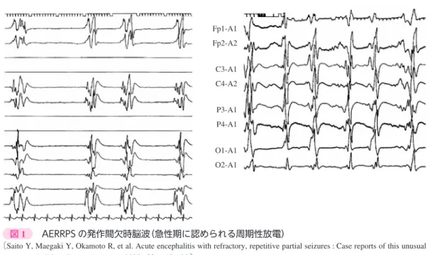 図 1 Fp1-A1Fp2-A2 C3-A1C4-A2P3-A1P4-A1O1-A1O2-A1