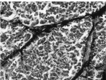 Figure 3. The CH40 was detected in the peripancreatic tissue, interlobular space, and lymph canal within the interlobular space.