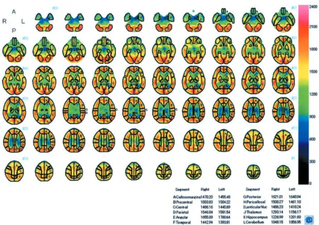 Fig. 4 shows the ‘relative rCBF (%)’, which is the percentage (%) of each segment ’ s rCBF to the  cor-responding hemisphere’s cerebral blood flow