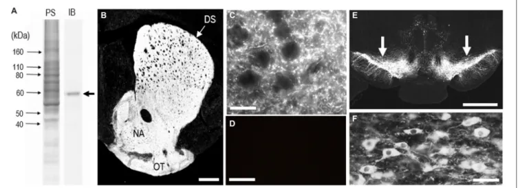 FIGURE 1 | Identification of tyrosine hydroxylase (TH) in the mouse striatum. (A) Western blot assay