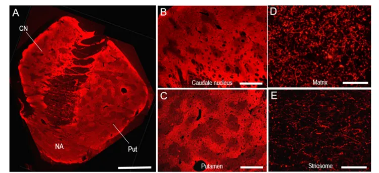 FIGURE 6 | Neostriatal mosaic visualized by TH-immunostaining with Cyanine 3 in human brains