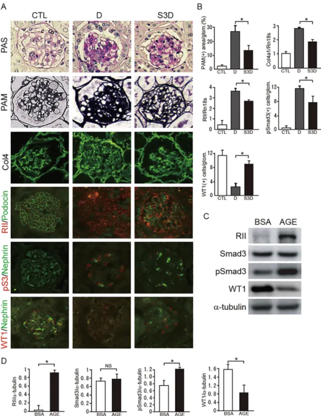 Fig 1. Effect of Smad3 deletion on phenotypic changes on podocytes in diabetic nephropathy
