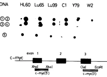 Fig.  3.  Nuclear  run-on  transcription  analysis  in  human  tumor  cell  lines.  The  incorporation  of 