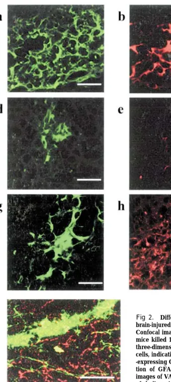 Fig 2 . Differentiation of ES-derived NPCs in the hippocampus of the brain-injured mice.