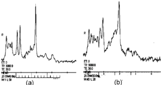 Fig. 7 : The difference in spectra between 3T (a) and 1.5T (b). The signal/noise ratio and resolution of the peaks are markedly  dif-ferent.