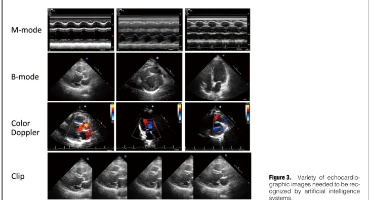 Figure 3.  Variety of echocardio- echocardio-graphic images needed to be  rec-ognized by artificial intelligence  systems.