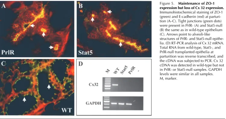 Figure 5. Maintenance of ZO-1  expression but loss of Cx 32 expression. 