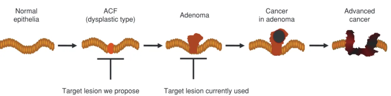 Figure 1 Colorectal carcinogenesis and target lesions for chemoprevention. In the majority of chemopreventive studies performed so far, adenoma has been used as a target lesion for evaluation