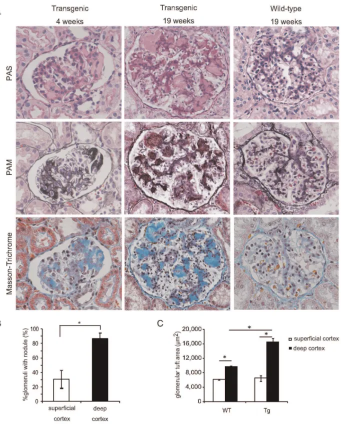 Figure 1. Renal pathological findings at age 4 and 19 weeks in transgenic pigs. A) In transgenic pigs, mesangial expansion commenced as early as 4 weeks