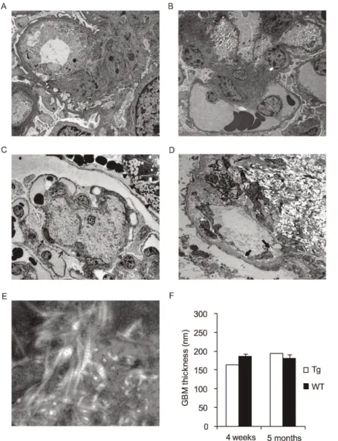 Figure 4. Transmission electron microscopy at age 4 weeks (A,B,E) and 5 months (C,D) in transgenic pigs