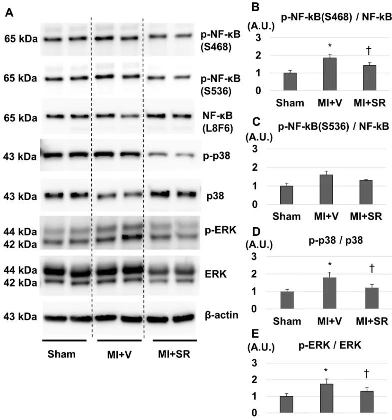 Fig 8. Western blotting analysis. (A) Representative images of western blotting for phospho-NF-κB p65 (S468 and S536), NF-κB, phospho-p38, p38,