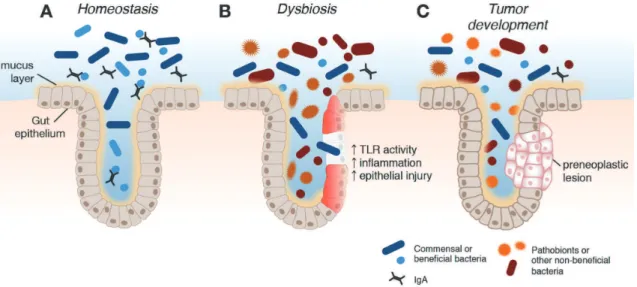 Fig. 5. A) Homeostasis between the gut microbiome and the intestinal epithelium exists when a beneficial bacteria population supports epithelial barrier function and a tolerant immune response
