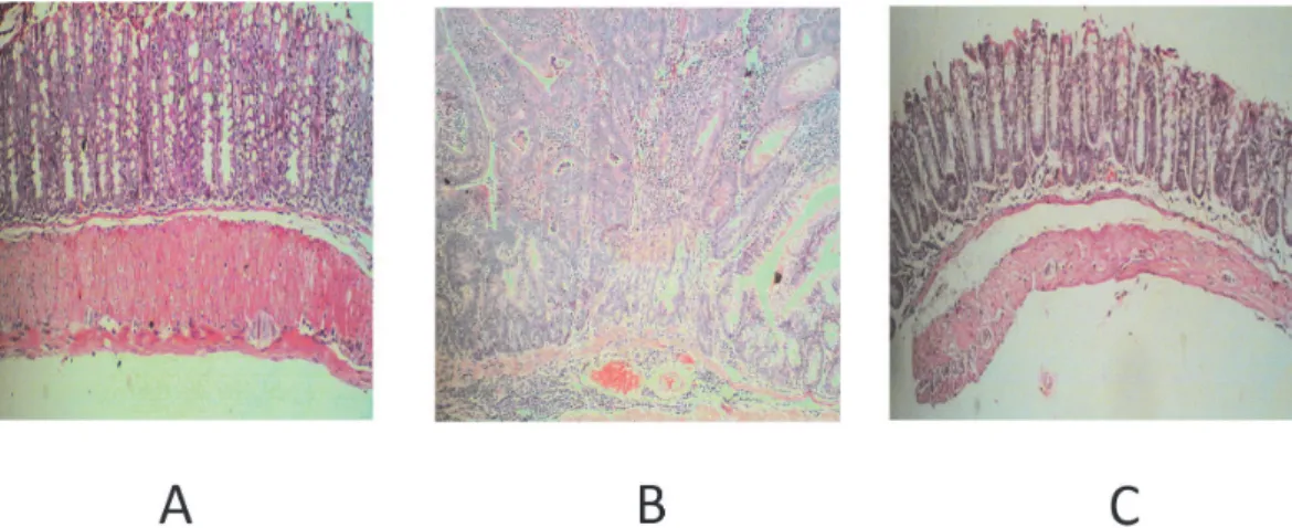 Fig. 4. Histopathology sections ofcolon. A, normal healthy mice f ed standard diet; B, azoxy- azoxy-methane/dextran sodium sulphate-induced mice fed a standard diet; C, AOM/DSS-induced mice fed the rice analog enriched with red palm oil (100×).