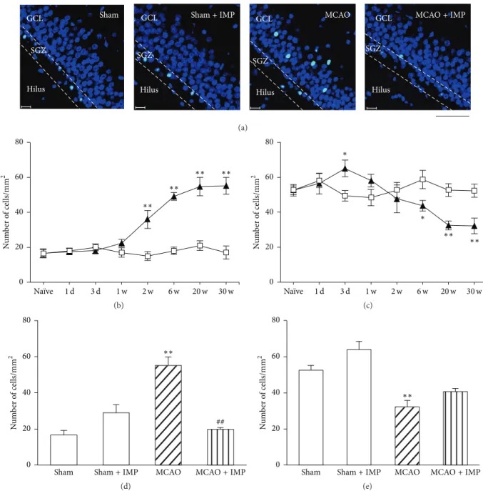 Figure 7: Analysis of the number of cleaved caspase-3 immunopositive cells in ipsilateral GCL and SGZ
