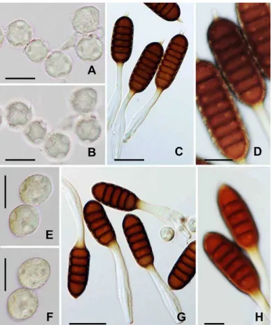 Fig. 3. Pharagmidium tuberculatum (A–D, IBAR-11184) and P. barclayi (E–H, IBAR-11189)