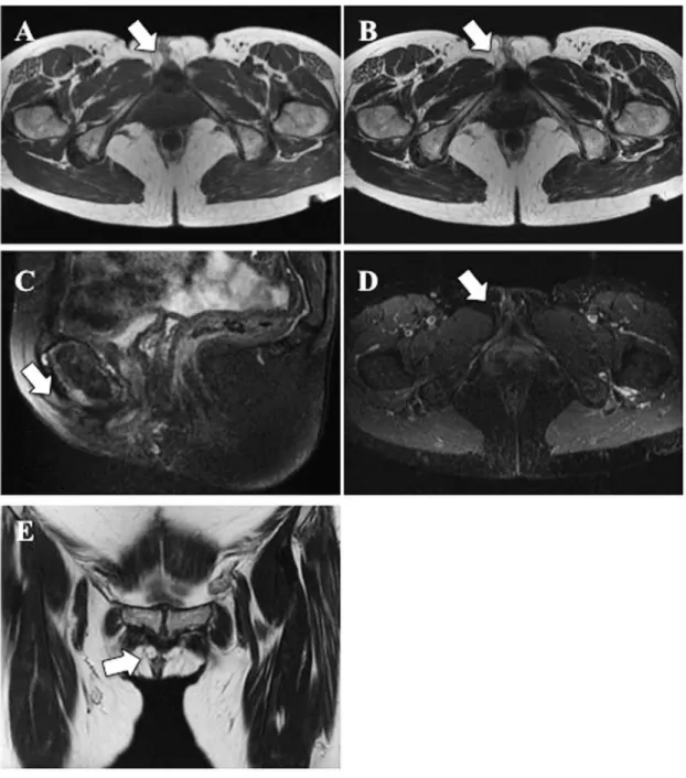 Figure 2 Follow - up MRI at 48 months