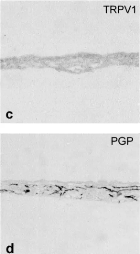 Fig. 3 IB4 - positive nerve fibers in a whole mount preparation (b - d). A bunch (Bu) is composed of IB4 - positive fine nerve fibers