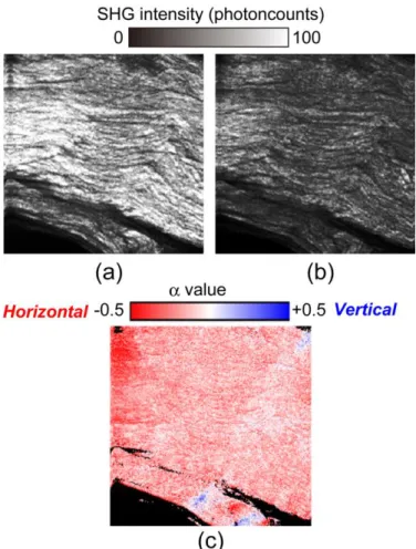 Fig. 4. (a) I H  image, (b) I V  image, and (c)    image when the collagen  orientation  of  the  sample  was  directed  at  the  horizontal  direction