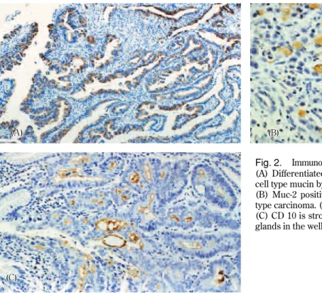 Table 4. Multivariate logistic regression analysis of lymph node metastasis
