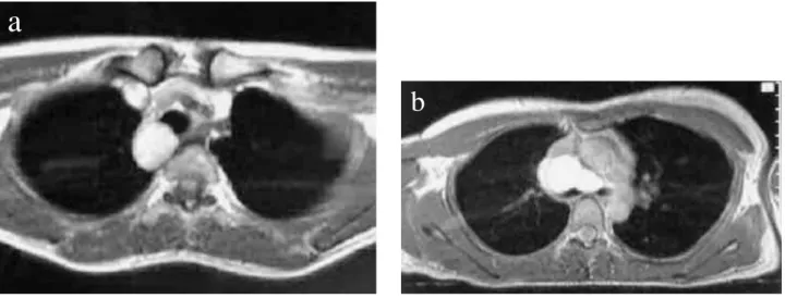 Figure 1. Preoperative MRI image of each case.