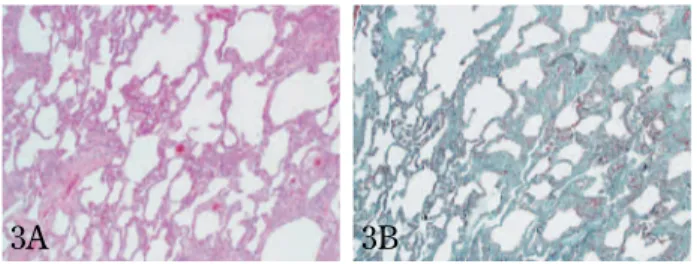 Figure 3B. Proliferated collagen fibers are greenly stained in the same sample as Figure 3A (the combination Verhoeff’s  elas-tic and Masson’s trichrome : Elaselas-tica-Masson, original  magnifi-cation ! 40).