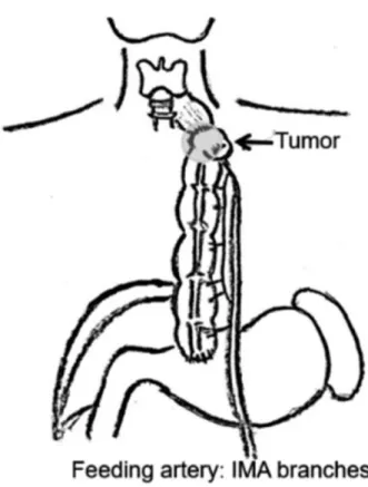 Table 1 Reported cases of adenocarcinoma with a colonic graft (1968- 2018) Authors Year Age/gender Reason for