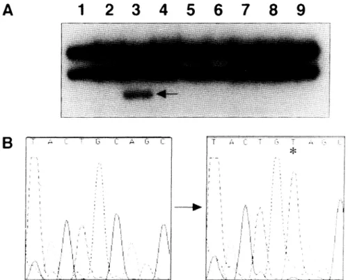 Fig.  1. PCR-SSCP analysis  and  nucleotide  sequence  analysis  of exon  2b of  the  GDNF  gene  in  human  pituitary  adenomas