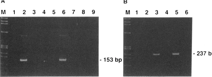 Fig.  3. Gene  expression  of  the  GDNF  gene  in  human  pituitary  adenomas  and  rodent  pituitary  tumor  cell  lines