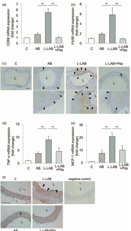 FIGURE 3 Effects of pitavastatin on aortic inflammatory responses. Graphs show mRNA expressions of aortic inflammatory markers CD68 (a), F4/80 (b), TNF-a (d), and monocyte chemoattractant protein-1 (e)