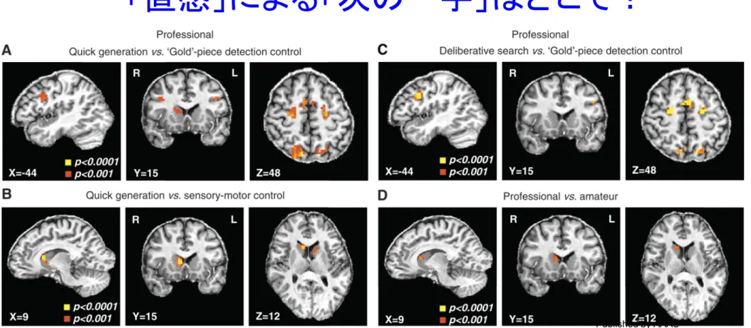 Fig. 2 Activations associated with quick generation of the best next move   ..  