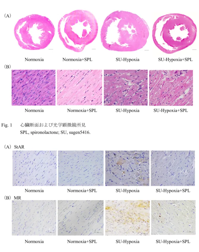 Fig. 1 心臓断面および光学顕微鏡所見