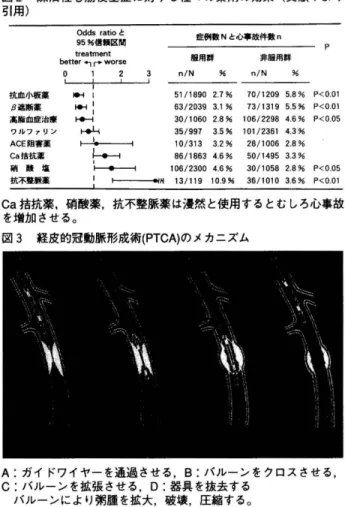 図 1 狭心症治療薬の使い方 ｜ β 遮断薬 ｜  硝酸薬 亡 二 Ca 措抗薬 円 刷 、 板 薬 ＝ ＝ コ 労作性狭心症には p 遮断薬が，冠軍縮性狭心症には Ca 措抗薬が 第 1 選択である 。硝酸薬は補完的に用いる 。 図 1 のように用いる 。 労作性狭心症には p 遮断薬が第一選択である。硝酸 薬と戸遮断薬と併用することにより相乗的な効果を得 られる 0 戸遮断薬が副作用（徐脈，気管支痘費量，四肢血 行不良等）で使用できない場合や病態に冠軍縮が関与し ている場合は，硝酸薬と Ca 措抗薬を併