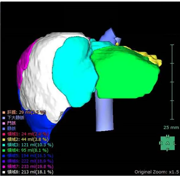 Fig 1. Volume calculation using SYNAPSE VINCENT. Simple volume of each liver subsegment (S1–S8), calculated using the 3D volume analyzer SYNAPSE VINCENT.