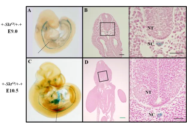 Figure 5. +-Skt Gt /+-+胚の脊索における LacZ 遺伝子発現 