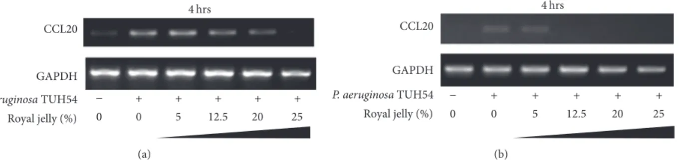 Figure 6: The inhibitory effect of royal jelly on CCL20 mRNA expression in human pharyngeal, Detroit 562 (a) and lung and NCI-H292 (b), epithelial cells stimulated with P