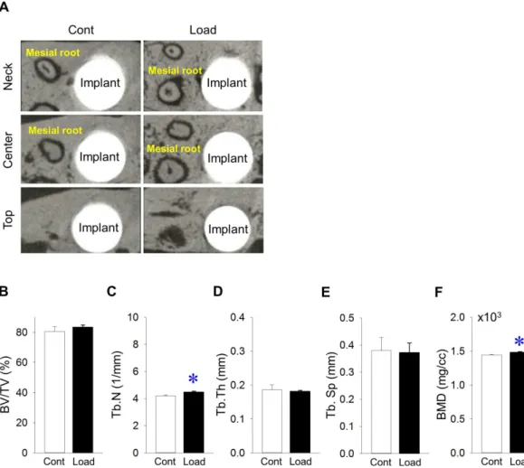 Fig 2. Effects of mechanical repetitive load on bone around implants. (A) Representative transverse microCT images at the neck, center and top of the implant