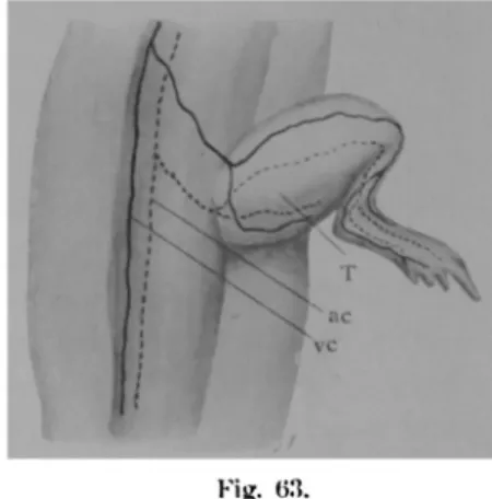 Fig.  62-66  :  Gefässver- Gefässver-halten  hei  der   homoio-plastischen   Transplanta-tion  der  Hinterbeinanlage  in  die  Schwanzknospe  bei 
