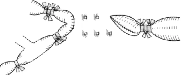 Fig 2. Surgical procedure for the vascular stumps.