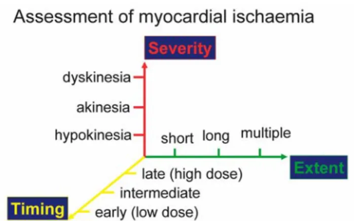 Fig. 2.  Assessing the magnitude of myocardial ischaemia in a three-dimensional model