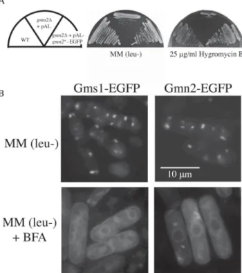 Fig. 5. Immunological dot-blot analysis of BiP secretion from the gmn2∆ strain.