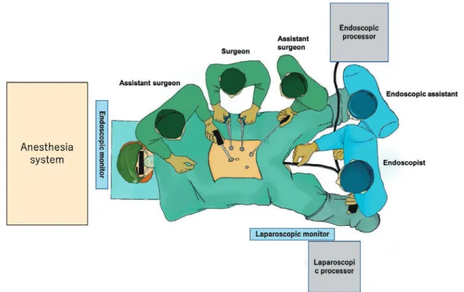 Figure   2a.   Suggested endoscope and laparoscope placement for cecal lesions.