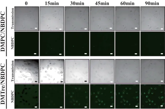 Fig. 4-3-6 Fluorescence micrographs of A549 cells treated with DMTre/NBDPC using  confocal laser microscope