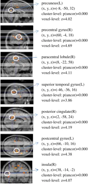 Table 1:  Direct comparison between neural activations in  beautiful design condition (beautiful design-ugly design) and 
