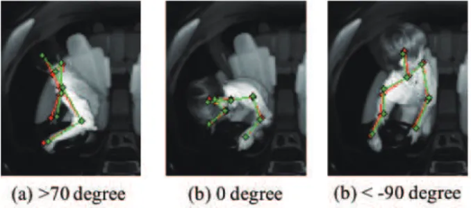 Figure 5 shows the face orientation estimation evaluation results. With a threshold value of 10 degree, the recognition rate was about 10% lower than when using a single DCNN