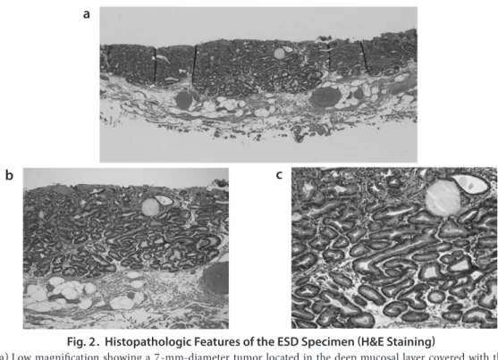 Fig. 2.  Histopathologic Features of the ESD Specimen (H&amp;E Staining)