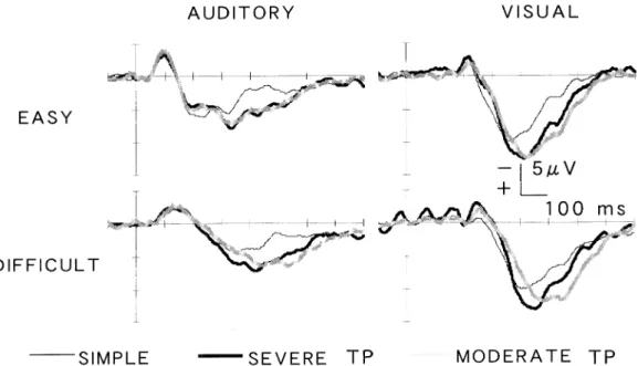 Figure  1.  Grand  average  of  ERPs  at  Pz  plotted  with  overlapping  waveforms  for  the  simple  reaction,  severe  TP,  and  moderate  TP  conditions